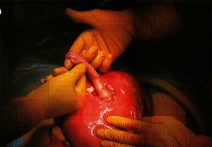 Welcome To The Womb