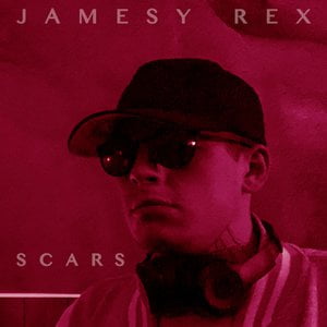 Scars