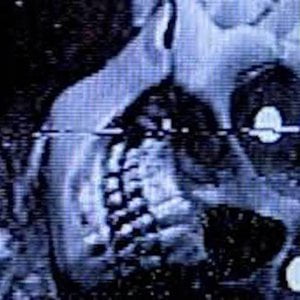 Bones