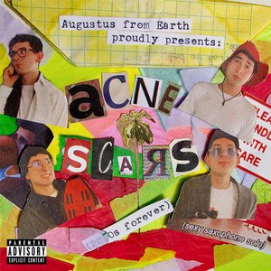 Acne Scars