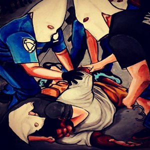 Is It Because I'm Black?